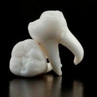 У молочных зубов есть корни, которые рассасываются